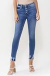 Ellerby Button Fly Mid Rise Crop Skinny Jeans